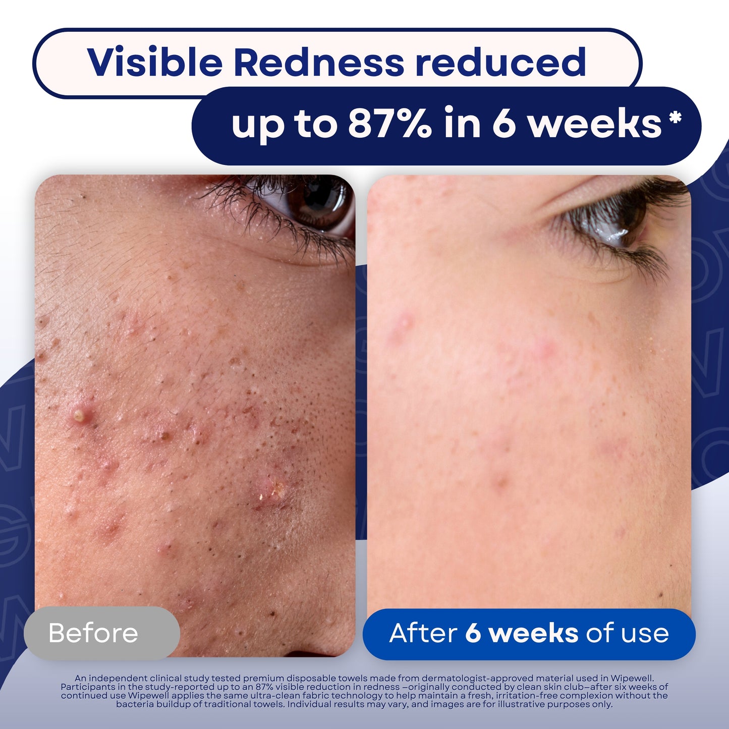 WipeWell – The Ultimate Duo Towel